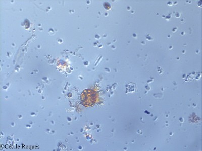 protozoo/Strobilidium sp.(1)(copy)_thumb.jpg